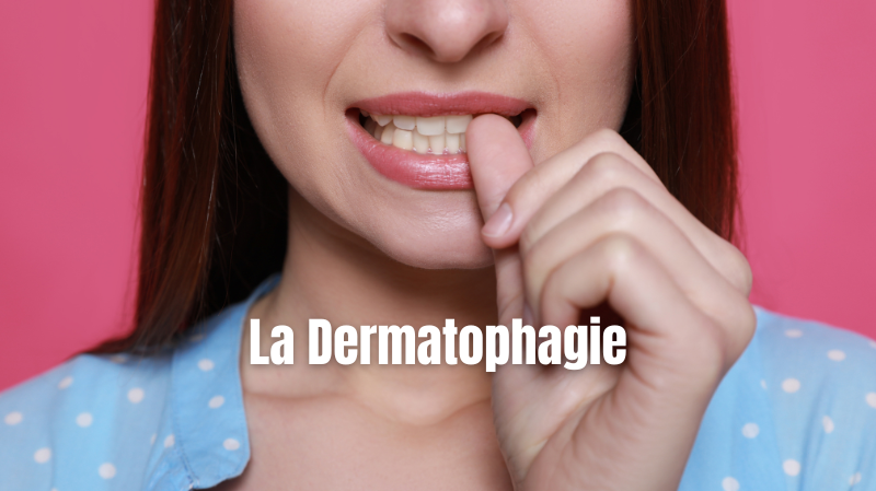 Surmonter la dermatophagie